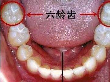 為(wèi)什麽不可(kě)忽視“六齡齒”