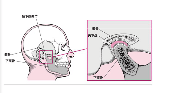 颞颌關節病與錯颌有(yǒu)什麽關系