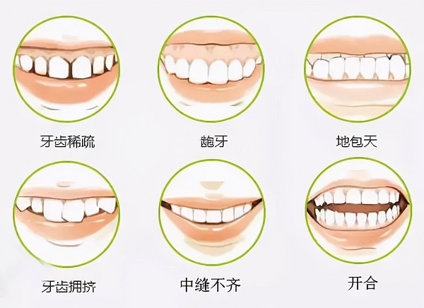 錯颌畸形的治療方法