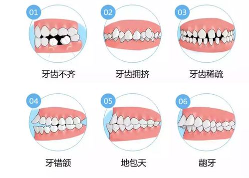 牙颌畸形有(yǒu)哪些危害