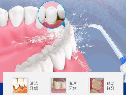 怎樣“洗牙”才能(néng)洗出健康