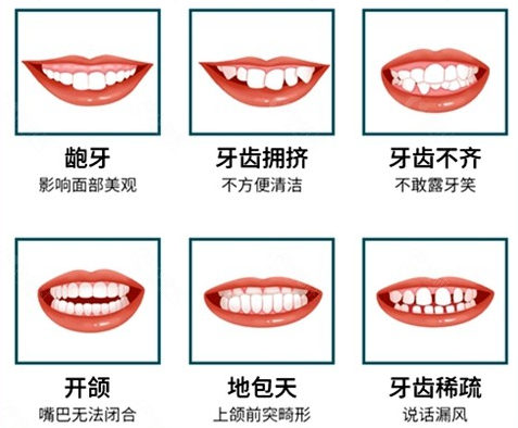 牙齒不整齊 不美觀是病嗎