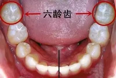 為(wèi)什麽要保護好“六齡齒”