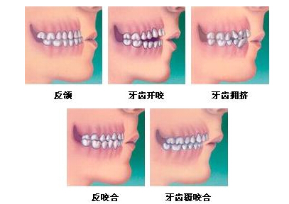 牙颌面畸形的治療原則